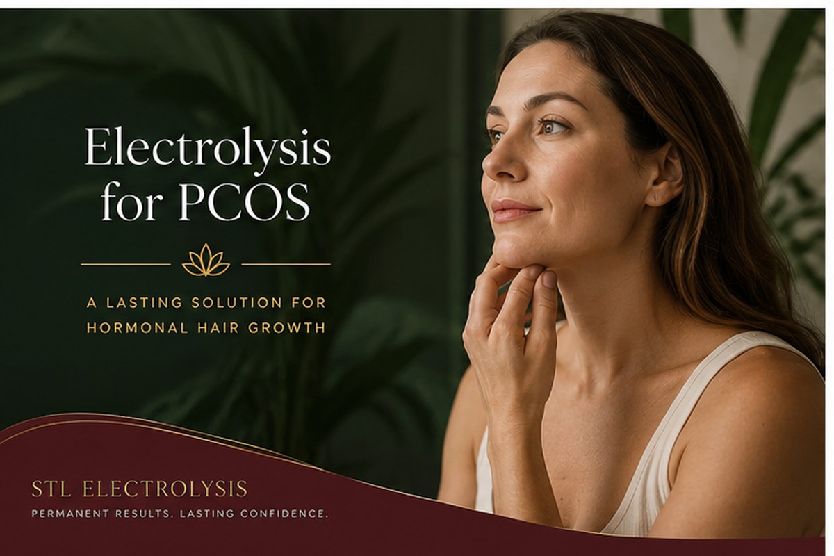 Electrolysis for PCOS article feature image with elegant editorial styling for hormonal hair growth